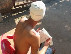 Homem é agredido em frente a bar no bairro Cristo Redentor